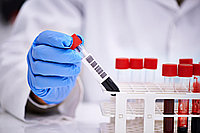 Основные наследственные заболевания (гены CFTR, GJB2, PAH, SMN) (Main Hereditary Diseases (Genes CFTR, GJB2,