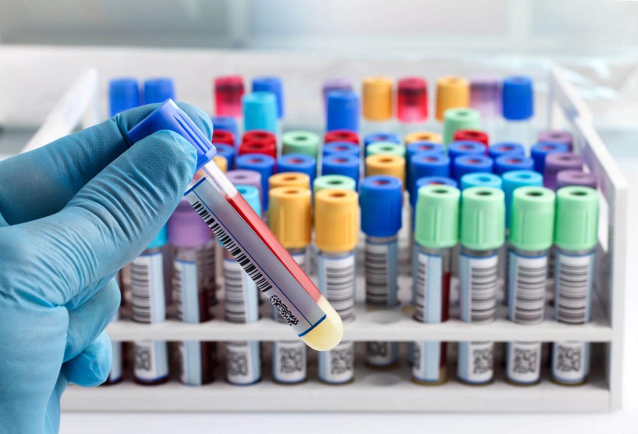 Цитохром CYP2C9 (ген CYP2C9) (Cytochrome CYP2C9 (Gene CYP2C9))