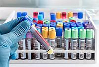 Цитохром CYP2C9 (ген CYP2C9) (Cytochrome CYP2C9 (Gene CYP2C9))