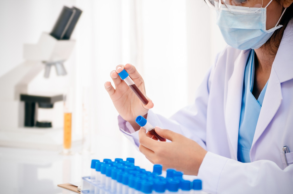 Нарушения детерминации пола. Анализ наличия гена SRY, м. (Disorders Sex Determination, Analysis Gene SRY,